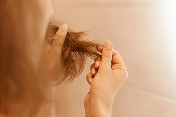 Hair Loss Treatment | Hair Restoration: Assure Clinic